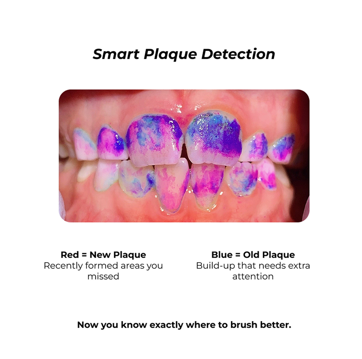 plaque disclosing tablets dental plaque indicator